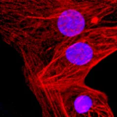 Human-heart-muscle-TSI