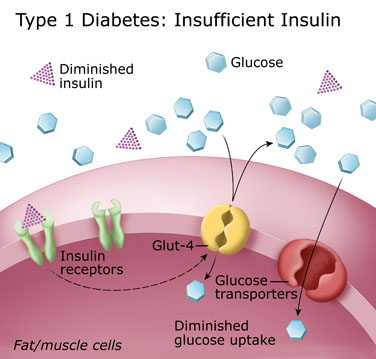 insufficient insulin